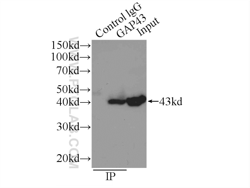 IP experiment of mouse brain using 16971-1-AP