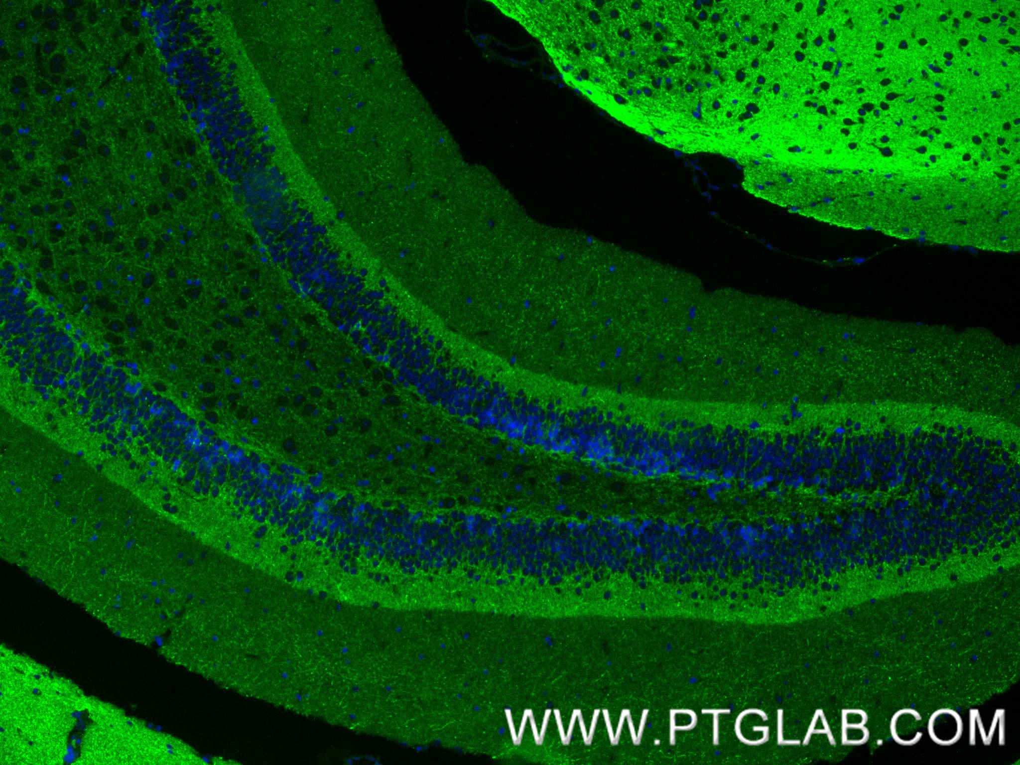 IF Staining of mouse brain using 87287-1-RR (same clone as 87287-1-PBS)
