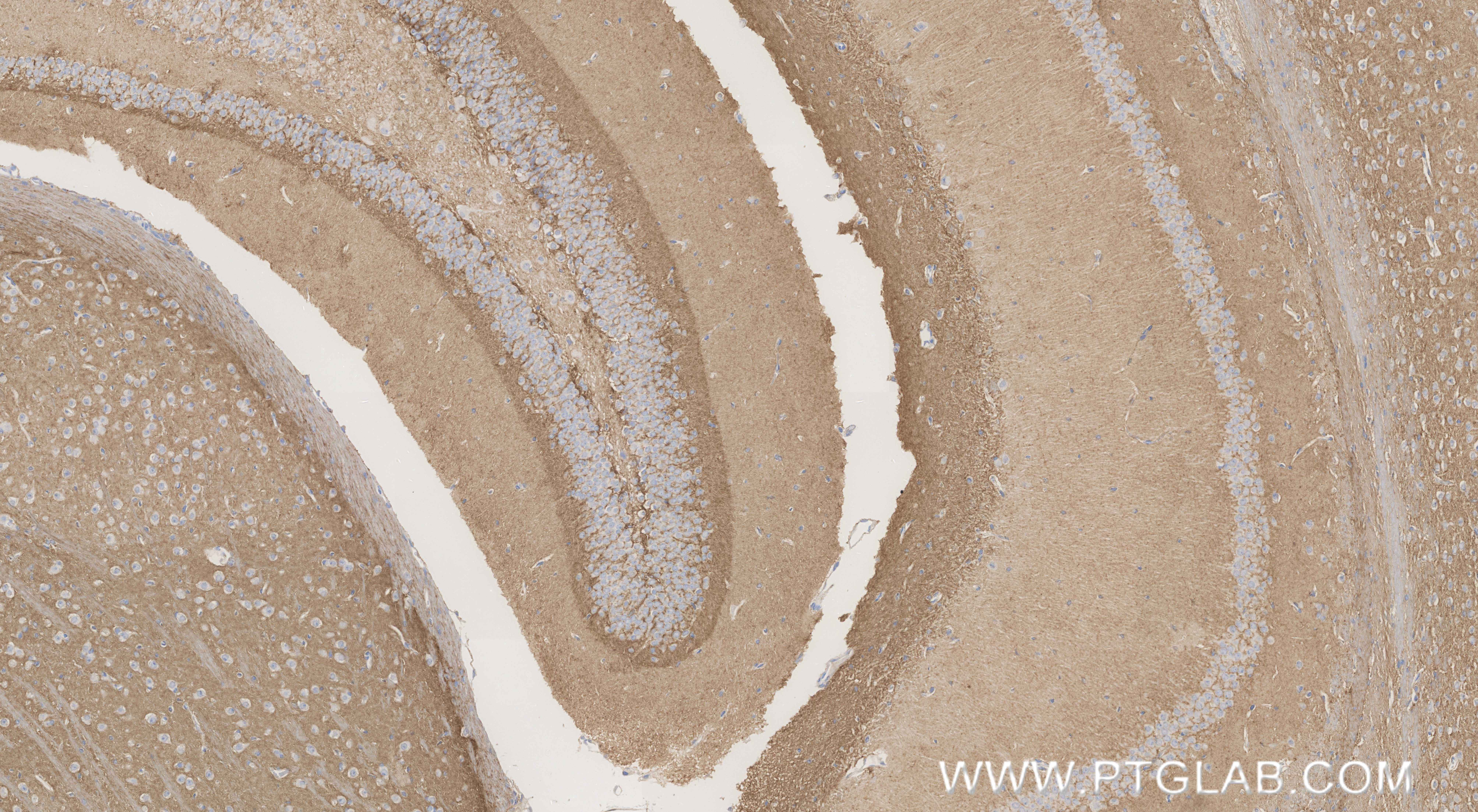 IHC staining of mouse brain using 87287-1-RR (same clone as 87287-1-PBS)