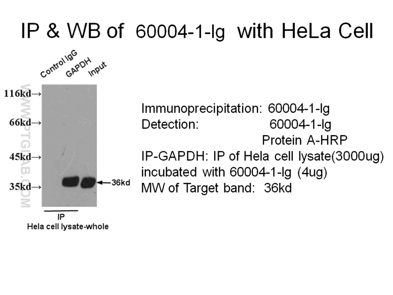 IP experiment of HeLa Cells using 60004-1-Ig (same clone as 60004-1-PBS)