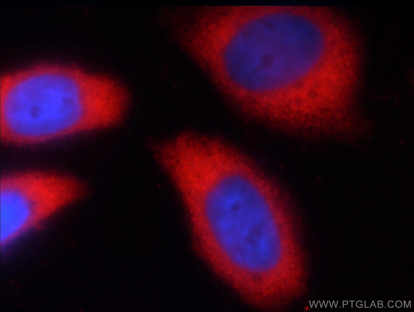 IF Staining of HeLa using 60004-1-Ig (same clone as 60004-1-PBS)