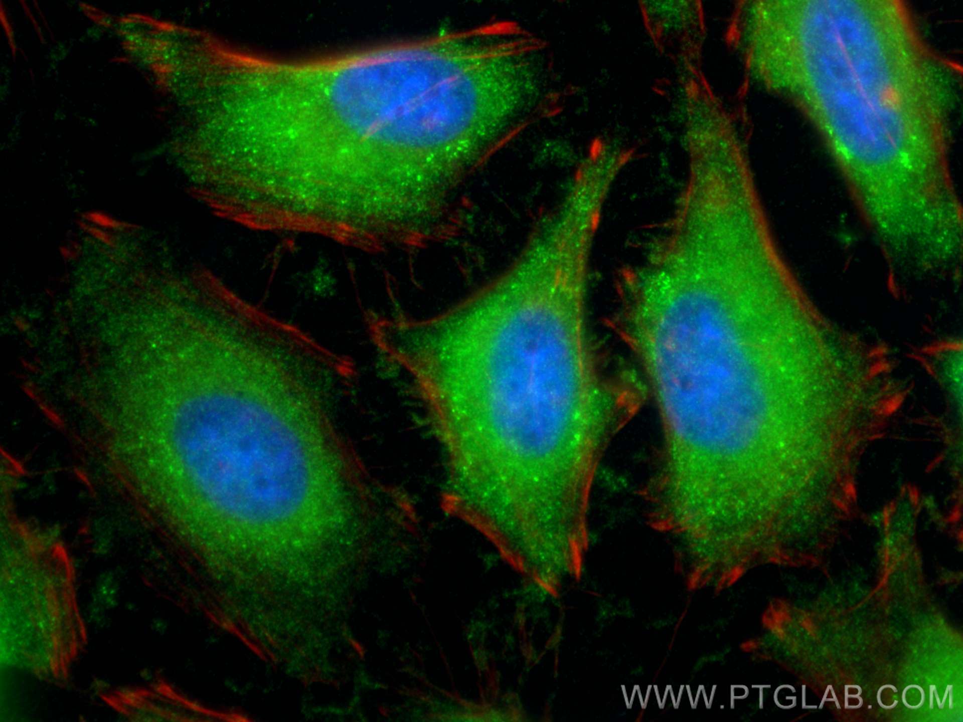 IF Staining of HeLa using 81640-5-RR (same clone as 81640-5-PBS)