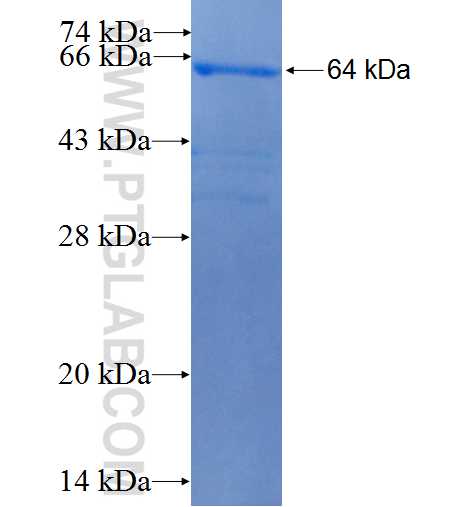 GAPDHS fusion protein Ag4988 SDS-PAGE