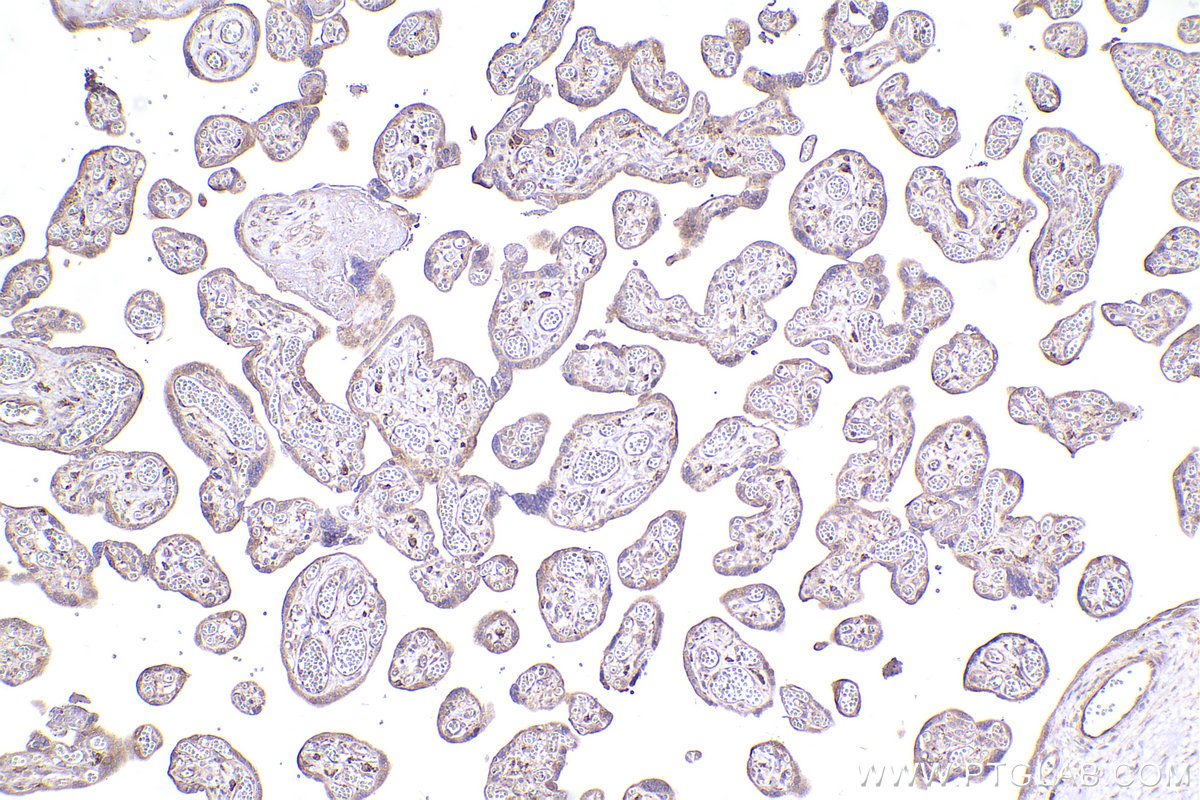 IHC staining of human placenta using 16940-1-AP