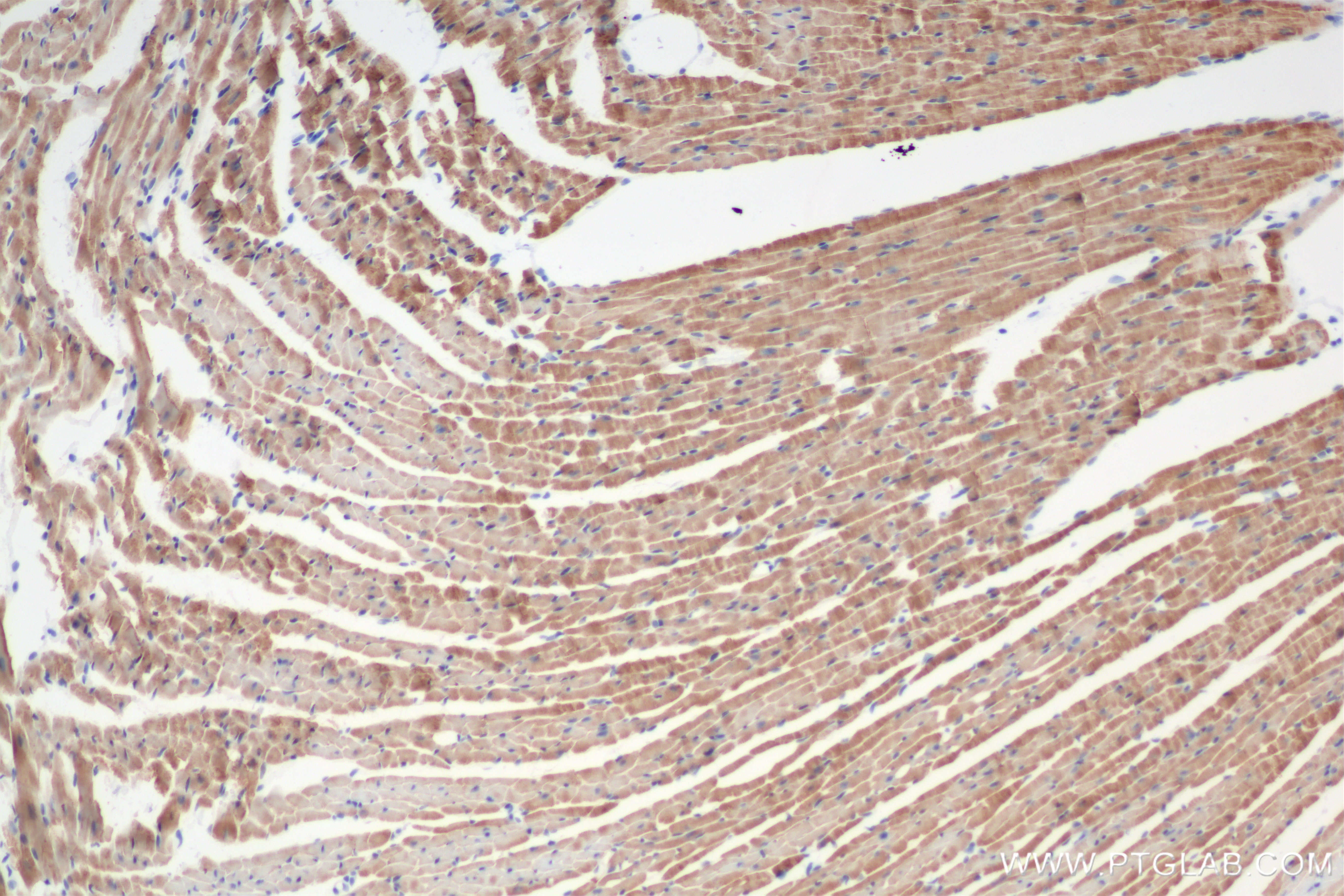 IHC staining of mouse heart using 84343-3-RR (same clone as 84343-3-PBS)
