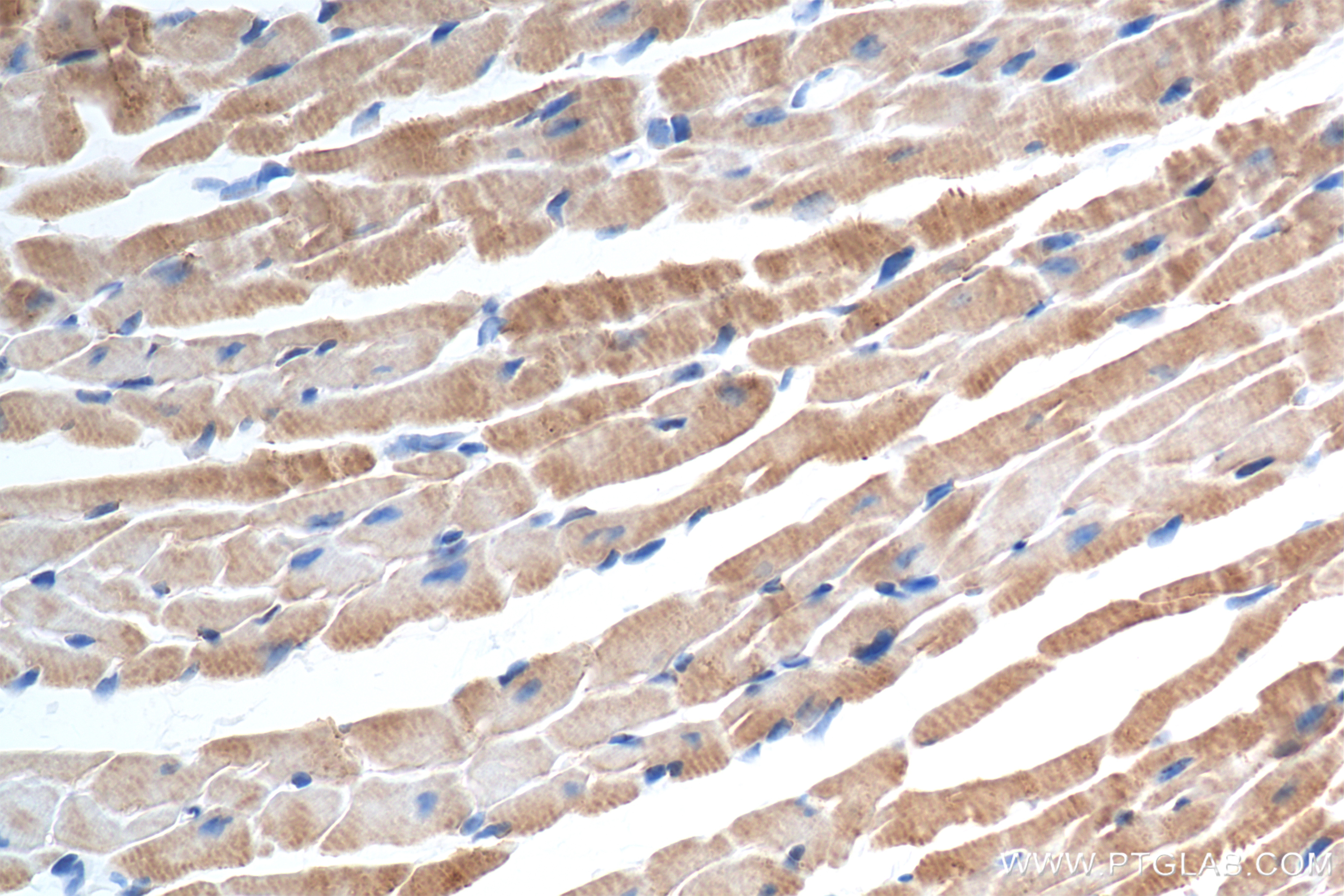 IHC staining of mouse heart using 84343-3-RR (same clone as 84343-3-PBS)