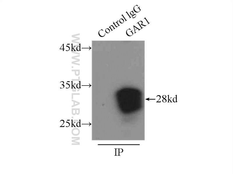 IP experiment of A375 using 11711-1-AP