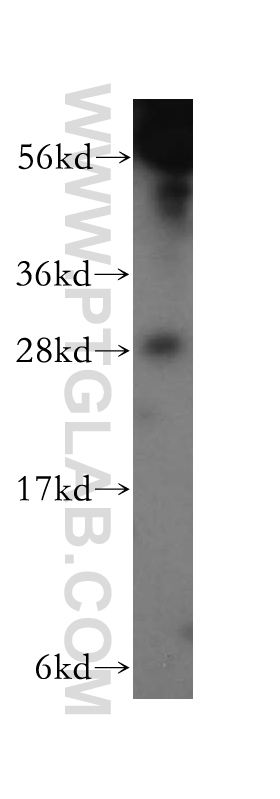 WB analysis of A375 using 11711-1-AP