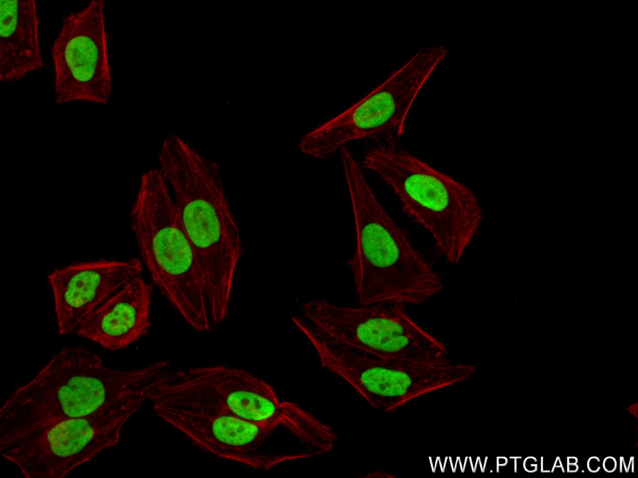 IF Staining of HepG2 using 83577-1-RR