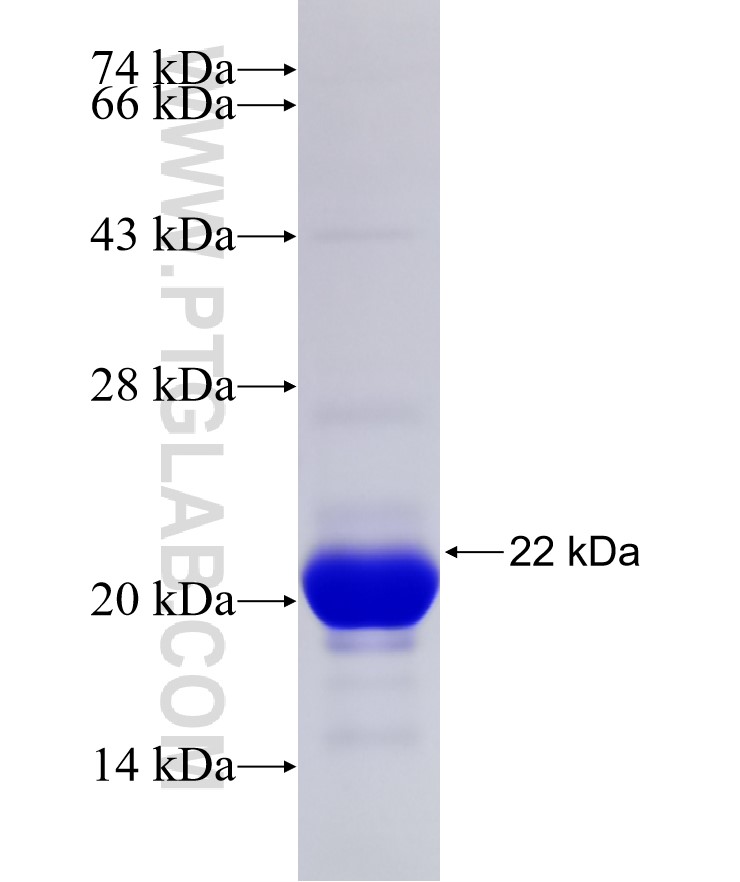 GARNL1 fusion protein Ag31546 SDS-PAGE GARNL1 fusion protein Ag31546 SDS-PAGE