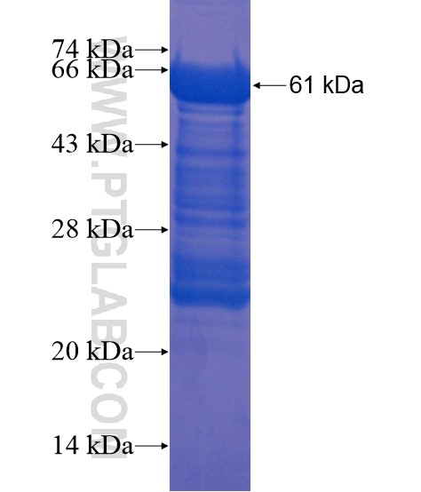 GARNL4 fusion protein Ag21840 SDS-PAGE