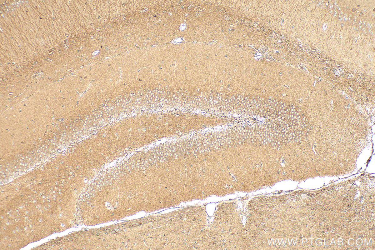 IHC staining of mouse brain using 15831-1-AP