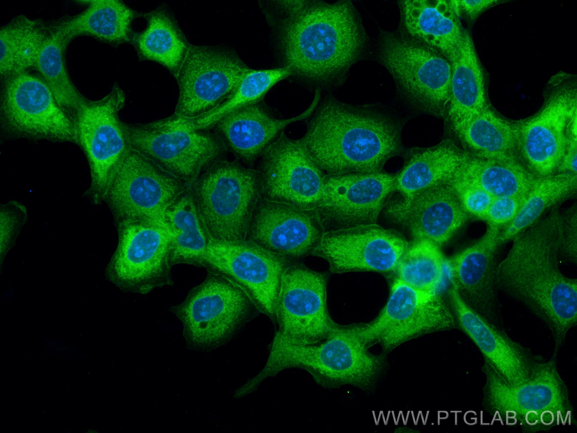 IF Staining of A431 using 67893-1-Ig