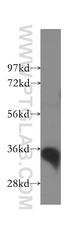 WB analysis of human kidney using 11941-2-AP