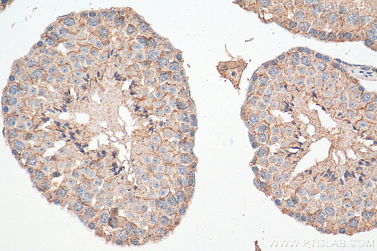 IHC staining of mouse testis using 68051-1-Ig (same clone as 68051-1-PBS)