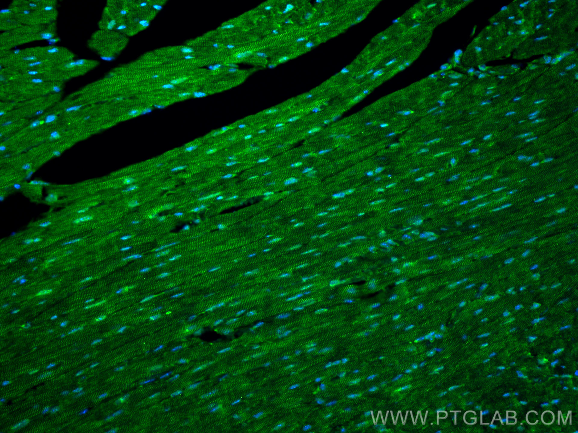 IF Staining of mouse heart using 13795-1-AP