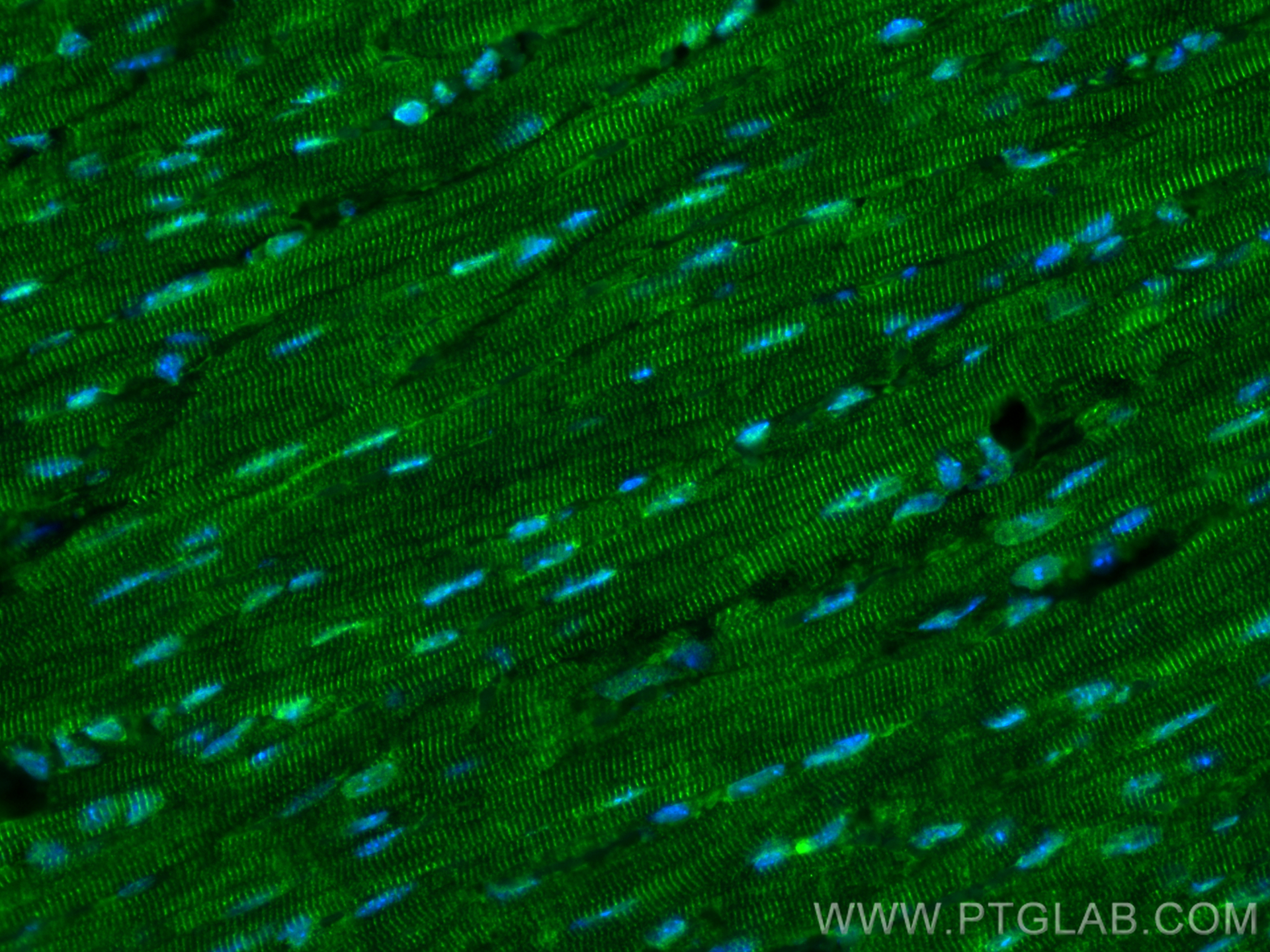 IF Staining of mouse heart using 13795-1-AP