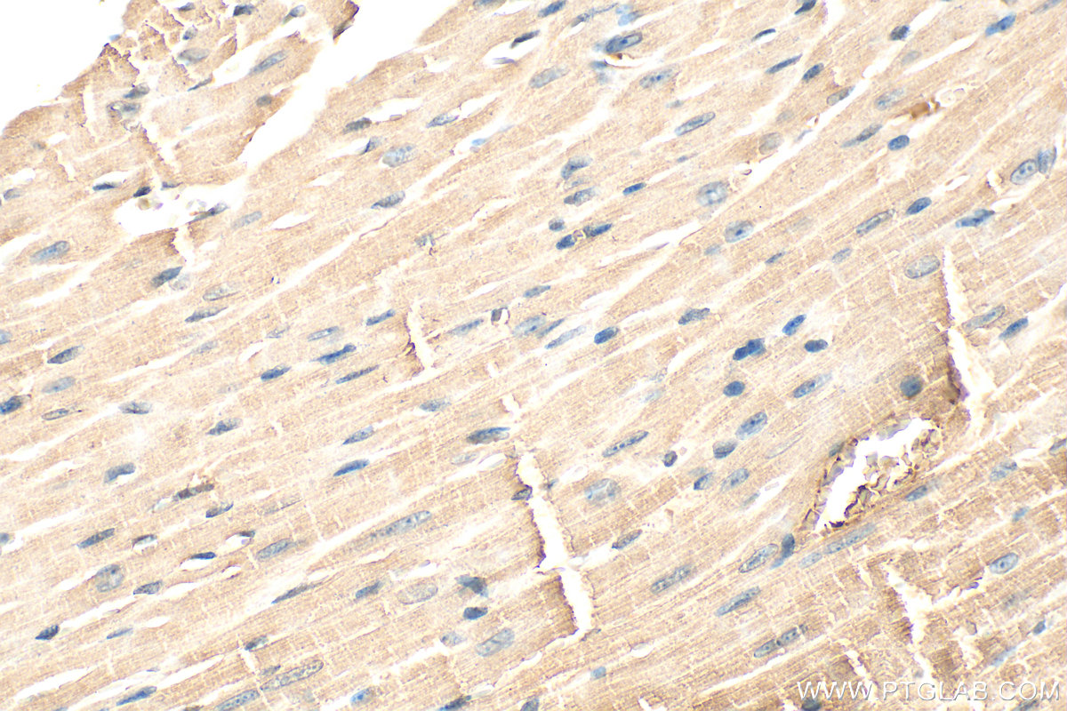 IHC staining of mouse heart using 13795-1-AP