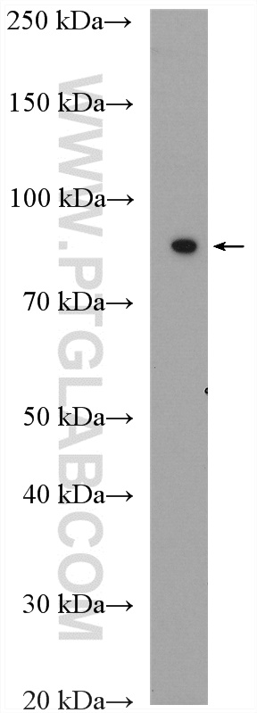 WB analysis of human urine using 13795-1-AP