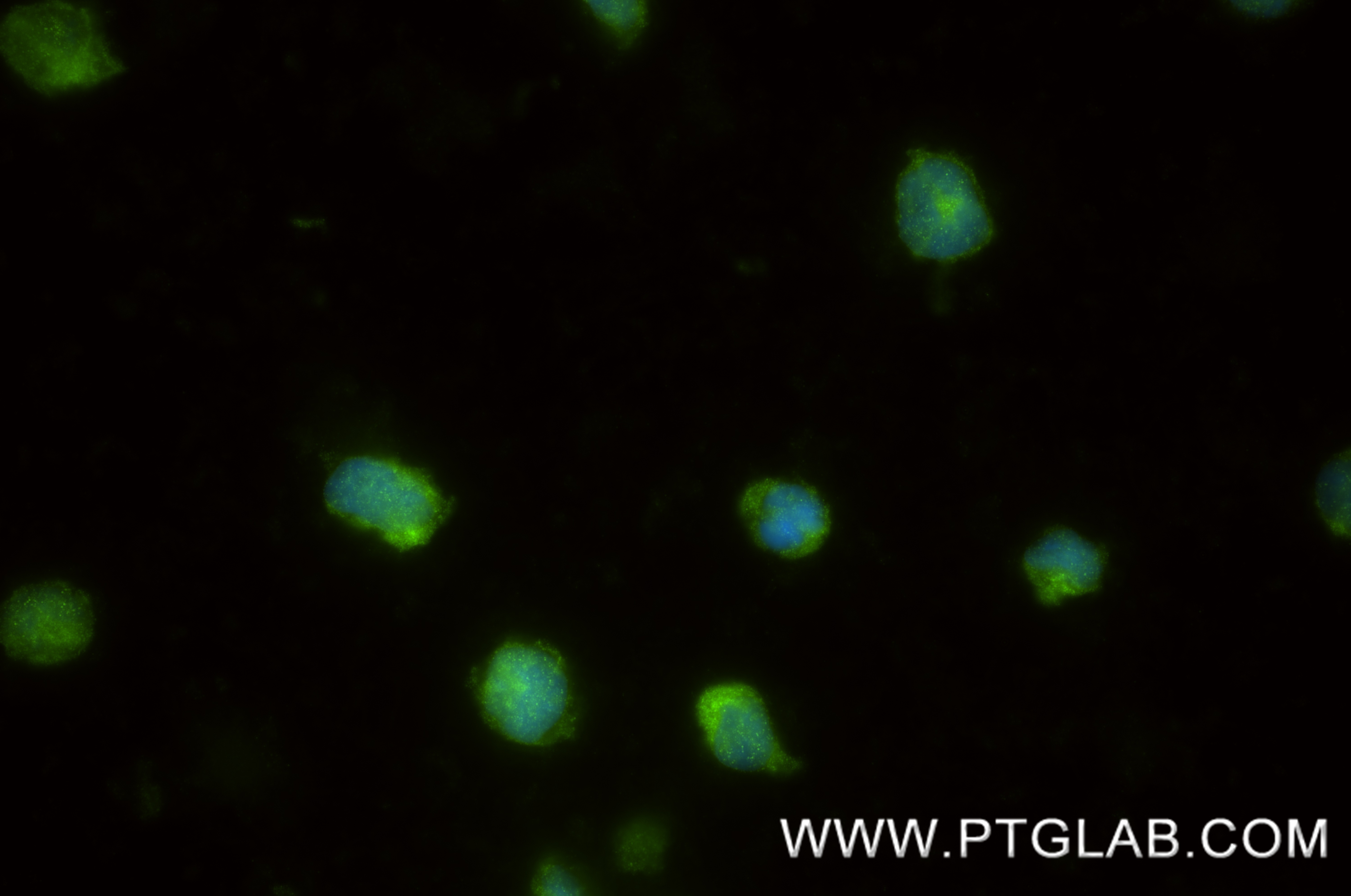 IF Staining of THP-1 using 87249-1-RR IF Staining of THP-1 using 87249-1-RR