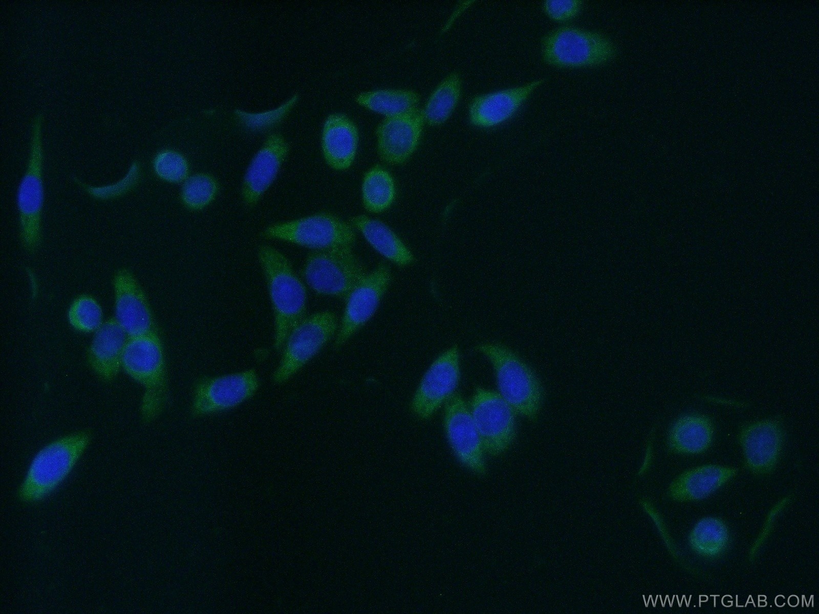 IF Staining of HeLa using 10072-1-AP