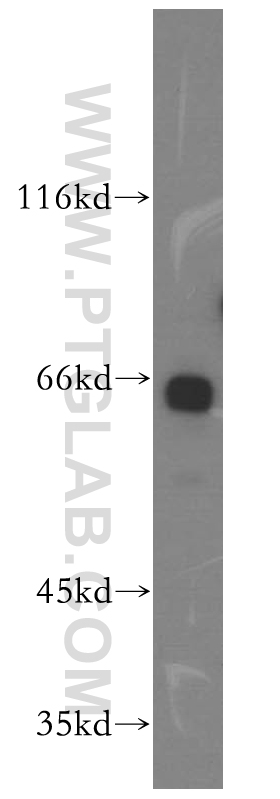 WB analysis of NIH/3T3 using 18270-1-AP