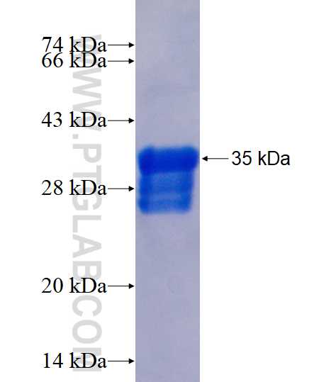 GAST fusion protein Ag12795 SDS-PAGE