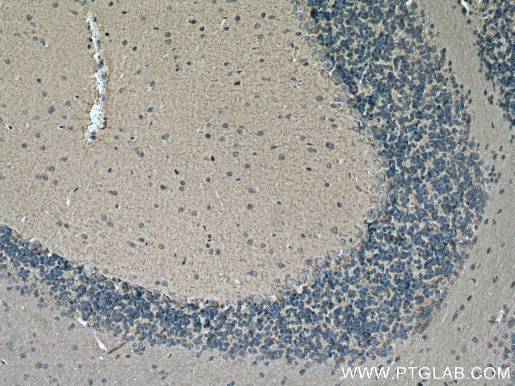 IHC staining of mouse cerebellum using 20298-1-AP (same clone as 20298-1-PBS)
