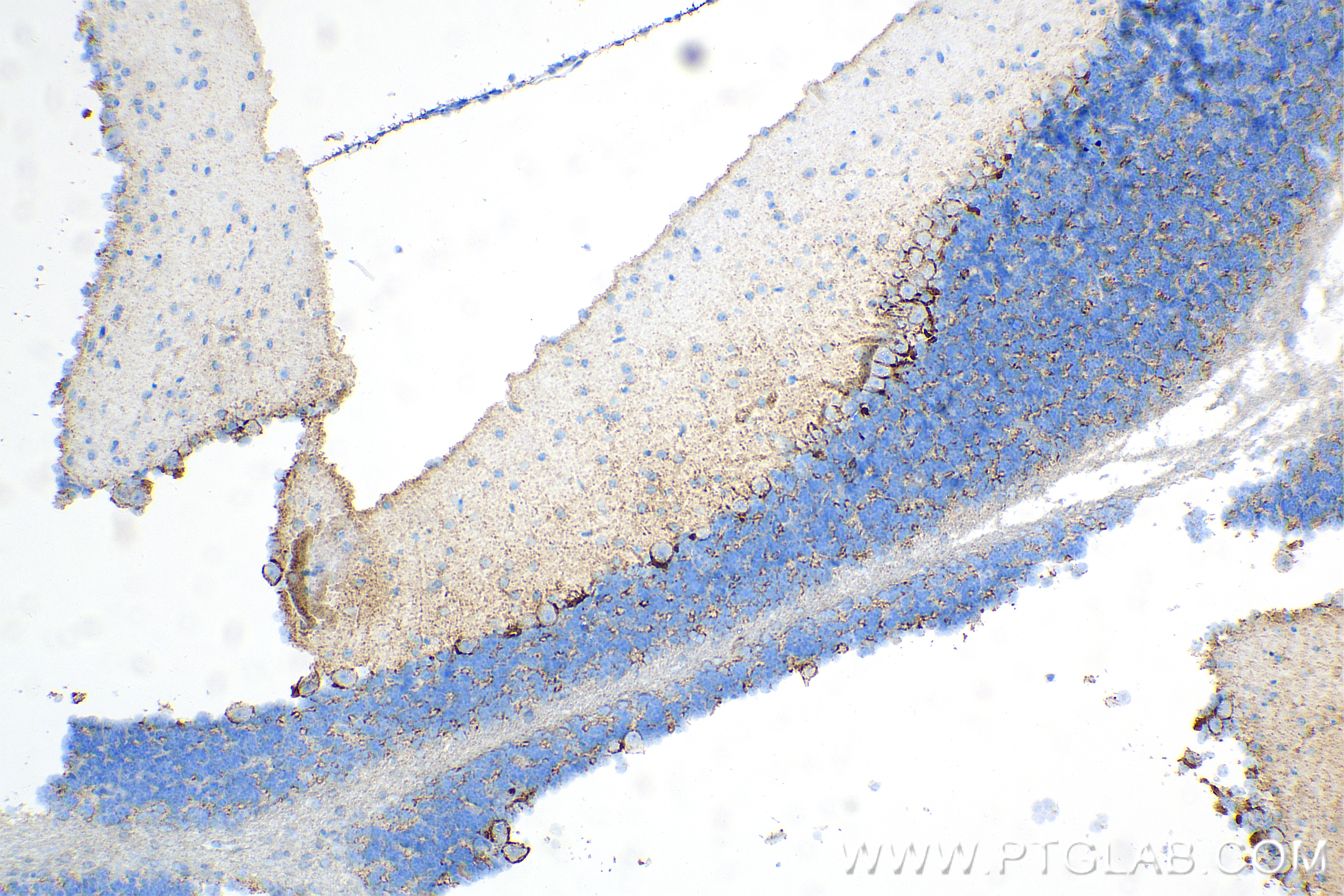 IHC staining of mouse cerebellum using 85060-2-RR (same clone as 85060-2-PBS)