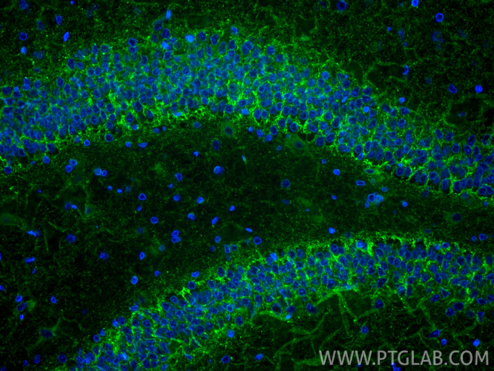 Immunofluorescent analysis of (4% PFA) fixed paraffin-embedded rat brain tissue using CoraLite® Plus 488 GAT1 antibody (CL488-85060-2, Clone: 242637D11 ) at dilution of 1:200. Heat mediated antigen retrieval with Tris-EDTA buffer (pH 9.0). IF Staining of rat brain using CL488-85060-2