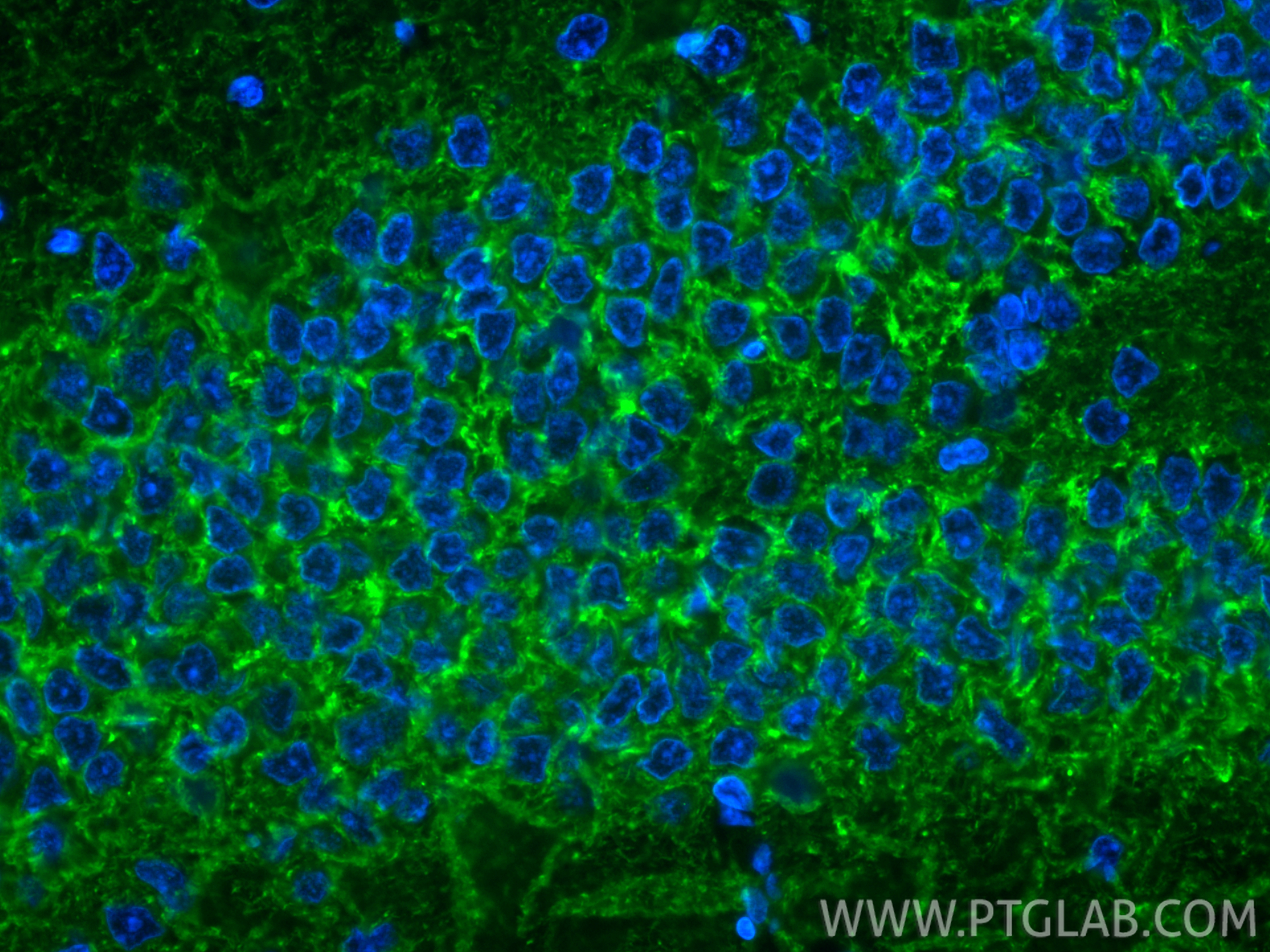 Immunofluorescent analysis of (4% PFA) fixed paraffin-embedded rat brain tissue using CoraLite® Plus 488 GAT1 antibody (CL488-85060-2, Clone: 242637D11 ) at dilution of 1:200. Heat mediated antigen retrieval with Tris-EDTA buffer (pH 9.0). IF Staining of rat brain using CL488-85060-2
