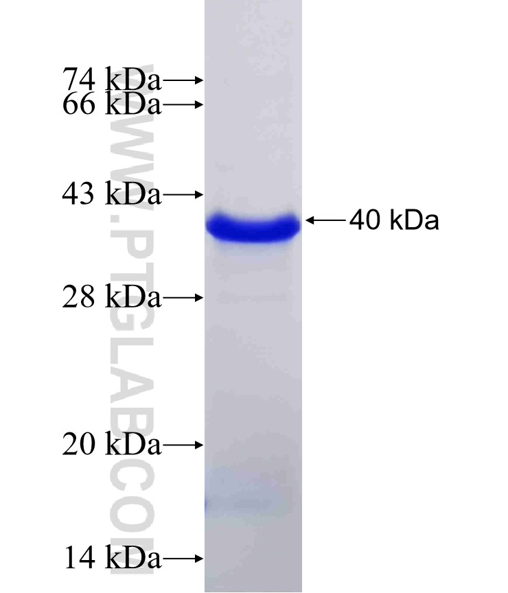 GATA1 fusion protein Ag16673 SDS-PAGE GATA1 fusion protein Ag16673 SDS-PAGE