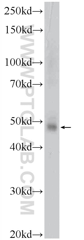 WB analysis of mouse thymus using 22343-1-AP