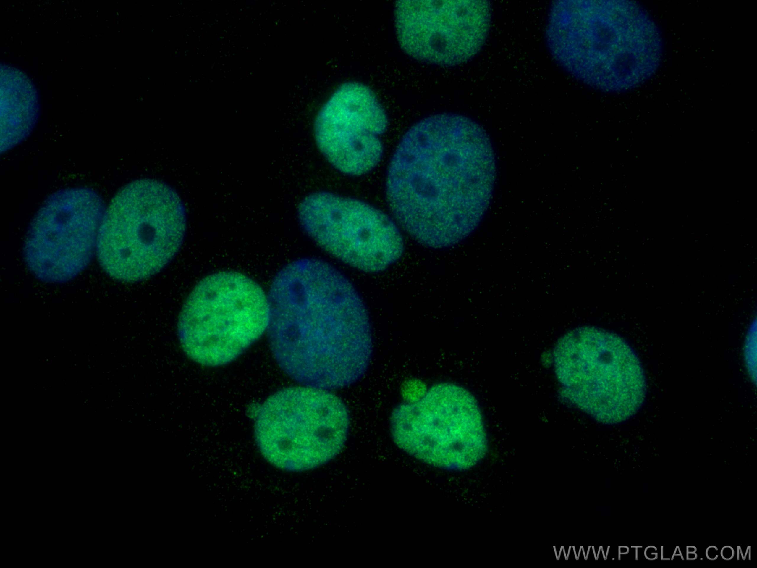 IF Staining of MCF-7 using 66400-1-Ig (same clone as 66400-1-PBS)