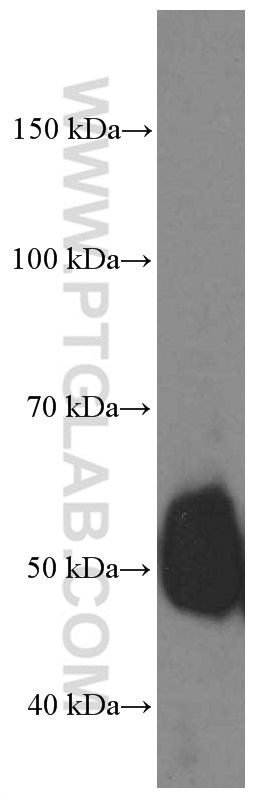 WB analysis of MCF-7 using 66400-1-Ig