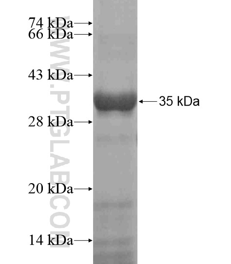 GATA3 fusion protein Ag19052 SDS-PAGE GATA3 fusion protein Ag19052 SDS-PAGE