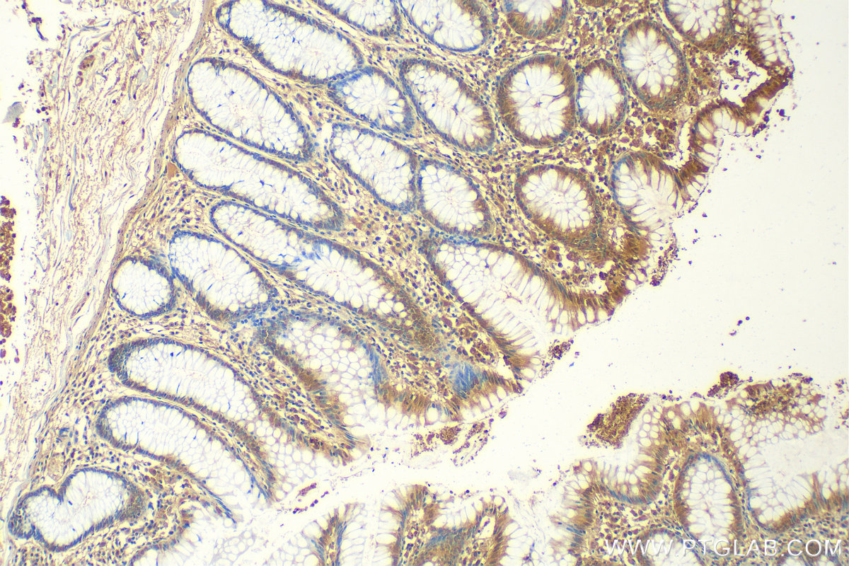 IHC staining of human colon using 55433-1-AP