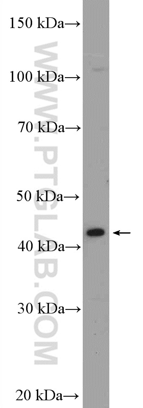 GATA5 Polyclonal antibody