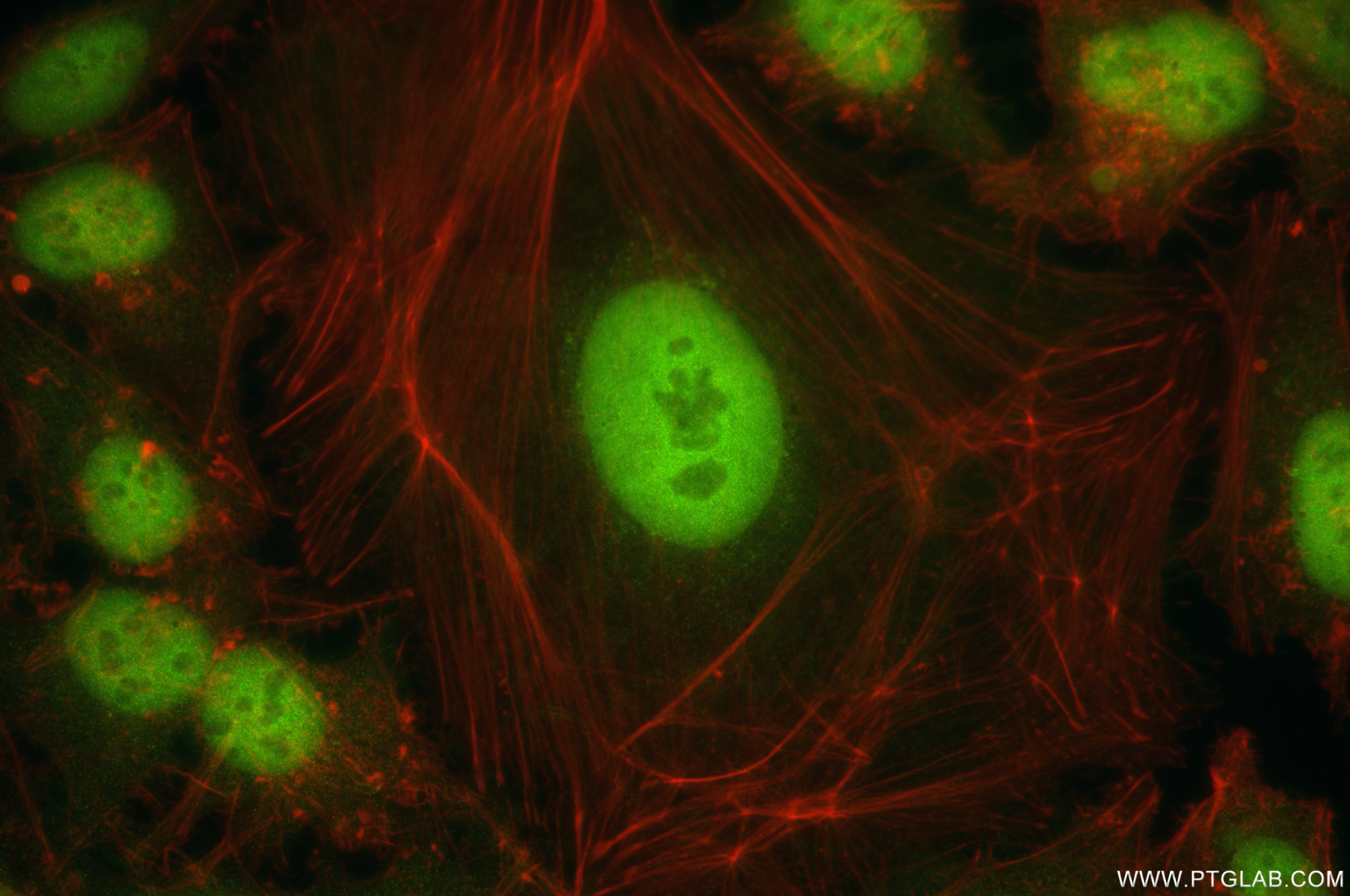 IF Staining of HeLa using 84987-3-RR