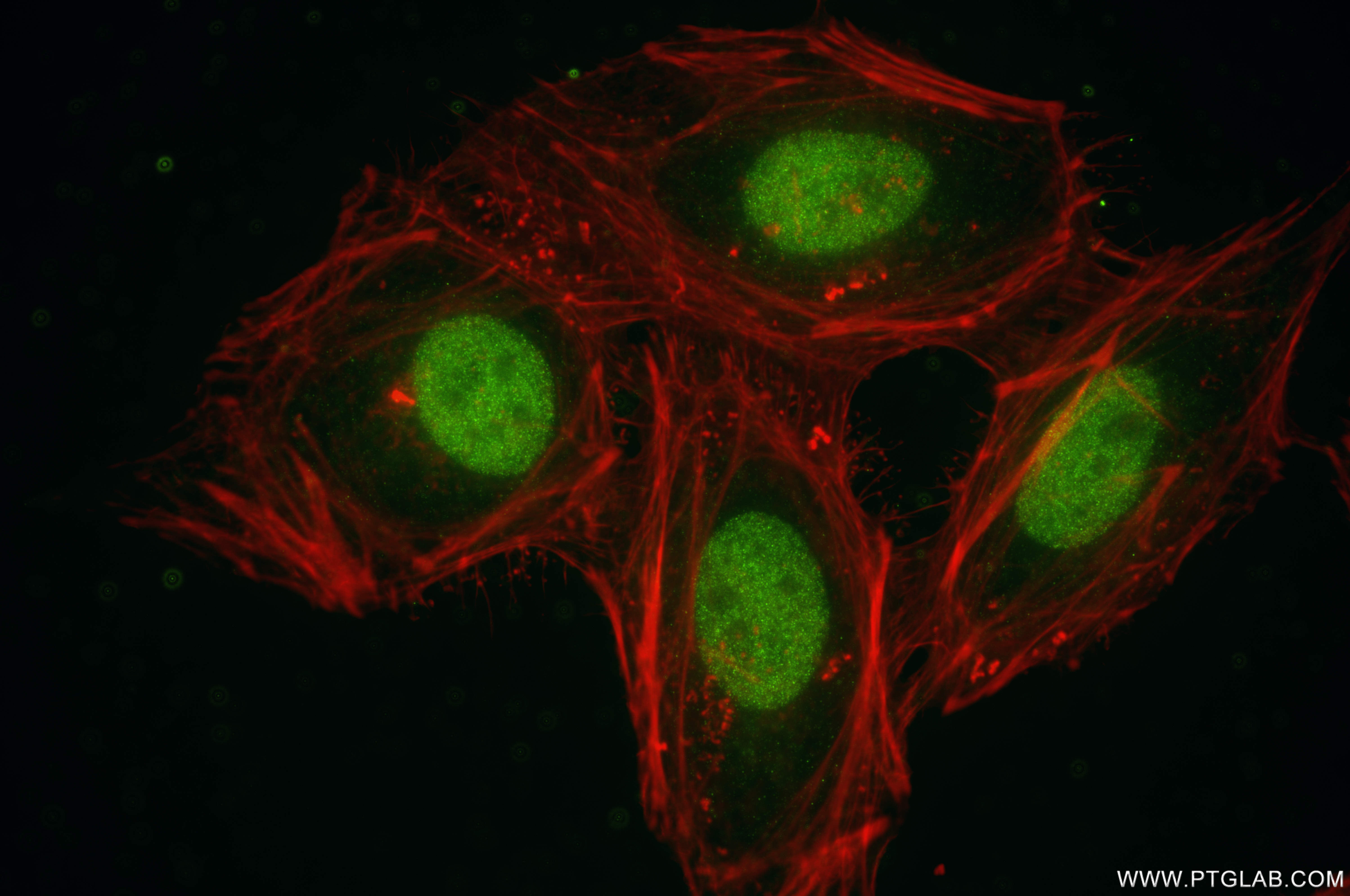 IF Staining of HeLa using 84987-5-RR (same clone as 84987-5-PBS)