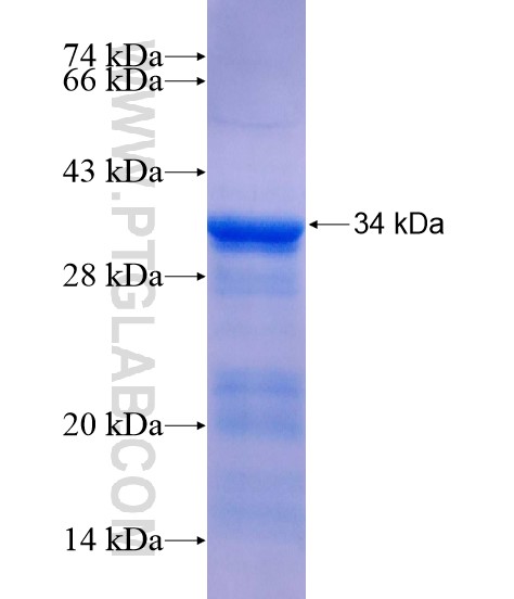 GATAD2A fusion protein Ag19238 SDS-PAGE GATAD2A fusion protein Ag19238 SDS-PAGE