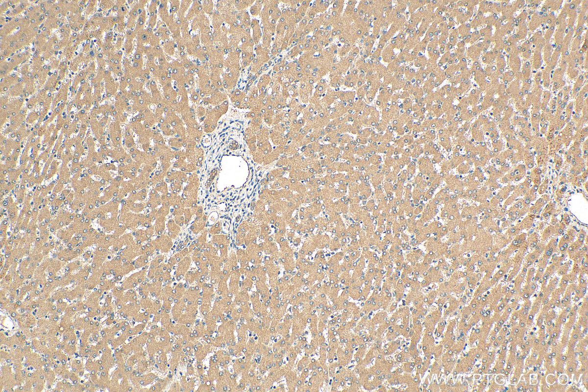 IHC staining of human liver using 23183-1-AP