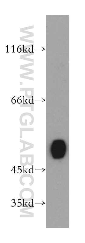 WB analysis of mouse kidney using 12801-1-AP