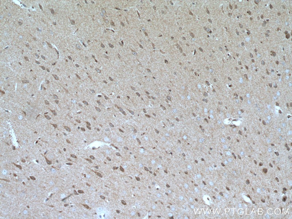 IHC staining of mouse brain using 27972-1-AP