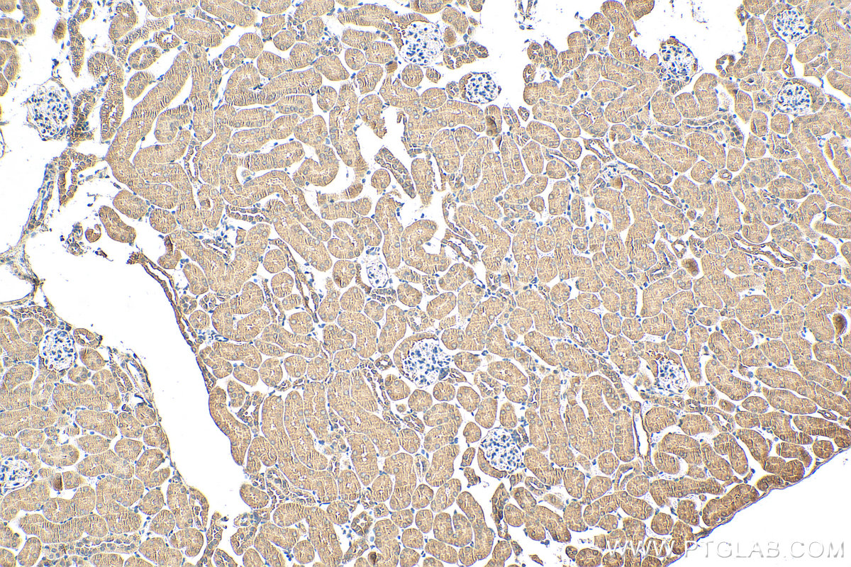 IHC staining of mouse kidney using 27972-1-AP