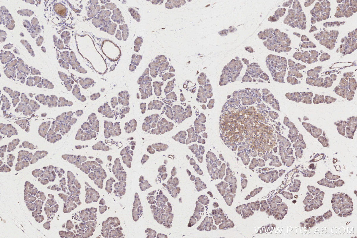 IHC staining of rat pancreas using 27972-1-AP IHC staining of rat pancreas using 27972-1-AP