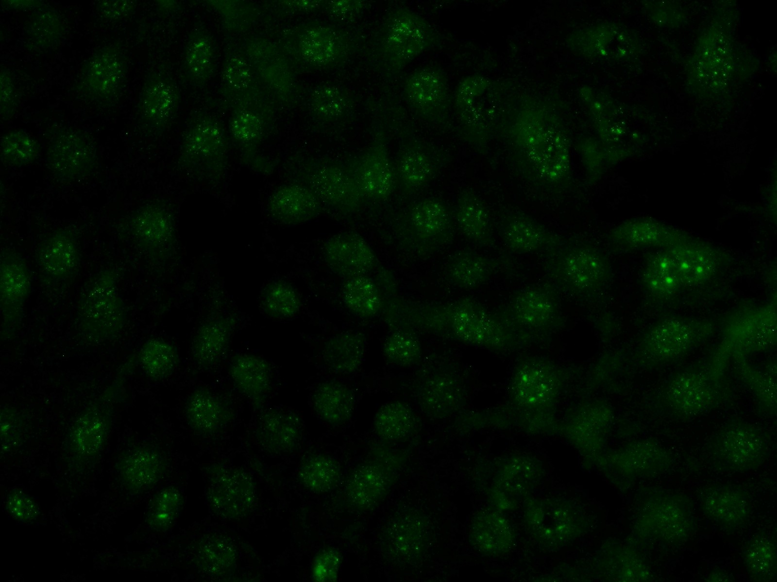 IF Staining of SH-SY5Y using 20622-1-AP