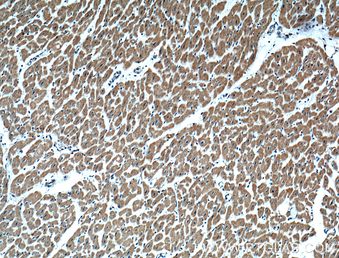 IHC staining of human heart using 18570-1-AP