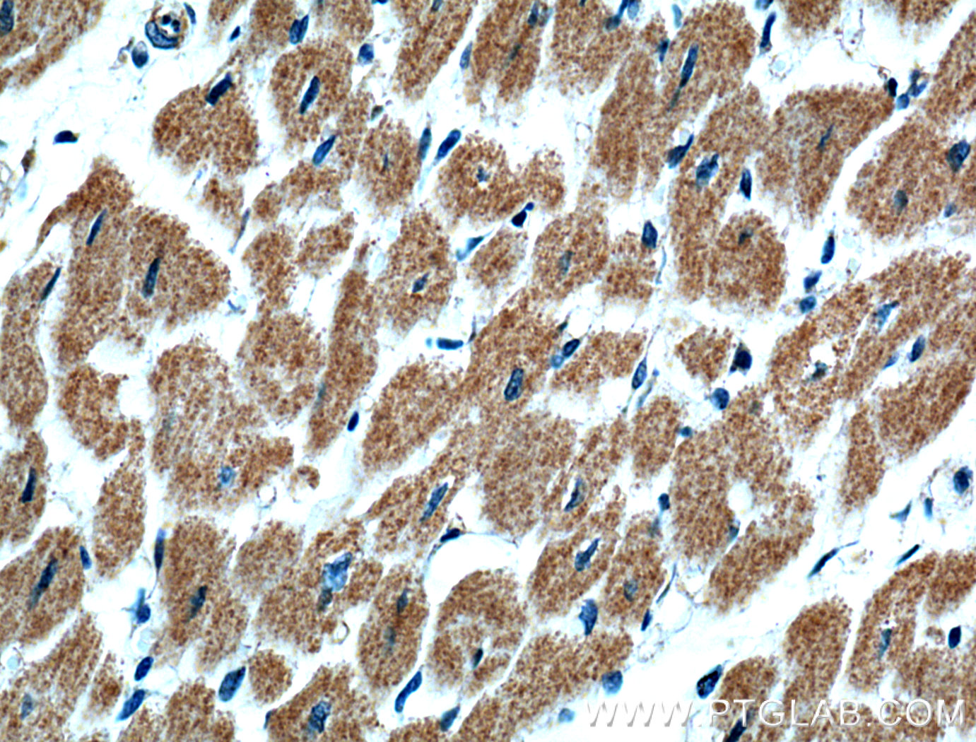 IHC staining of human heart using 18570-1-AP