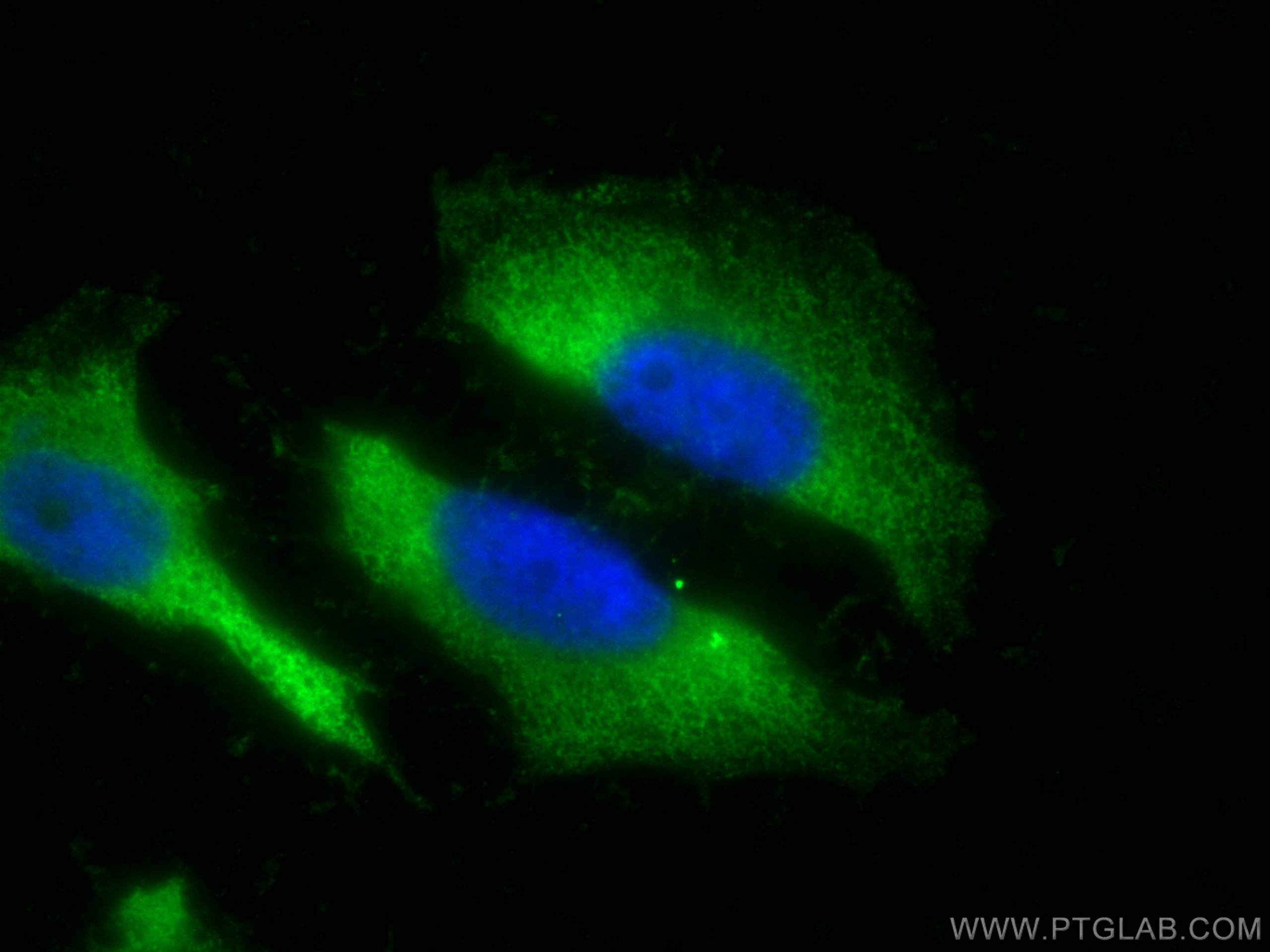 IF Staining of HeLa using 20313-1-AP